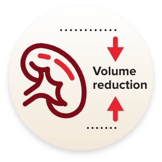 An illustrations of a spleen visualizing spleen volume reduction as a treatment management goal